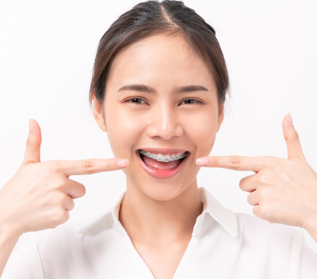 Orthodontics Benefits